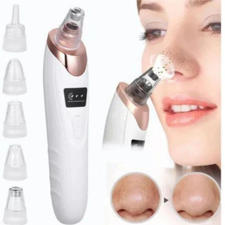 home-microdermabrasion-machine-8826-white